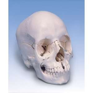    22 Part Beauchene Adult Human Skull