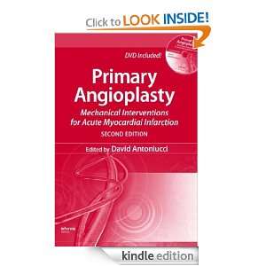 Primary Angioplasty Mechanical Interventions for Acute Myocardial 