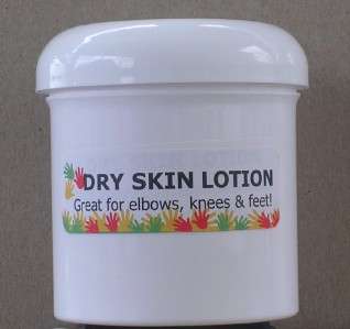 Dry skin lotion cream hand body foot home made 6 oz  